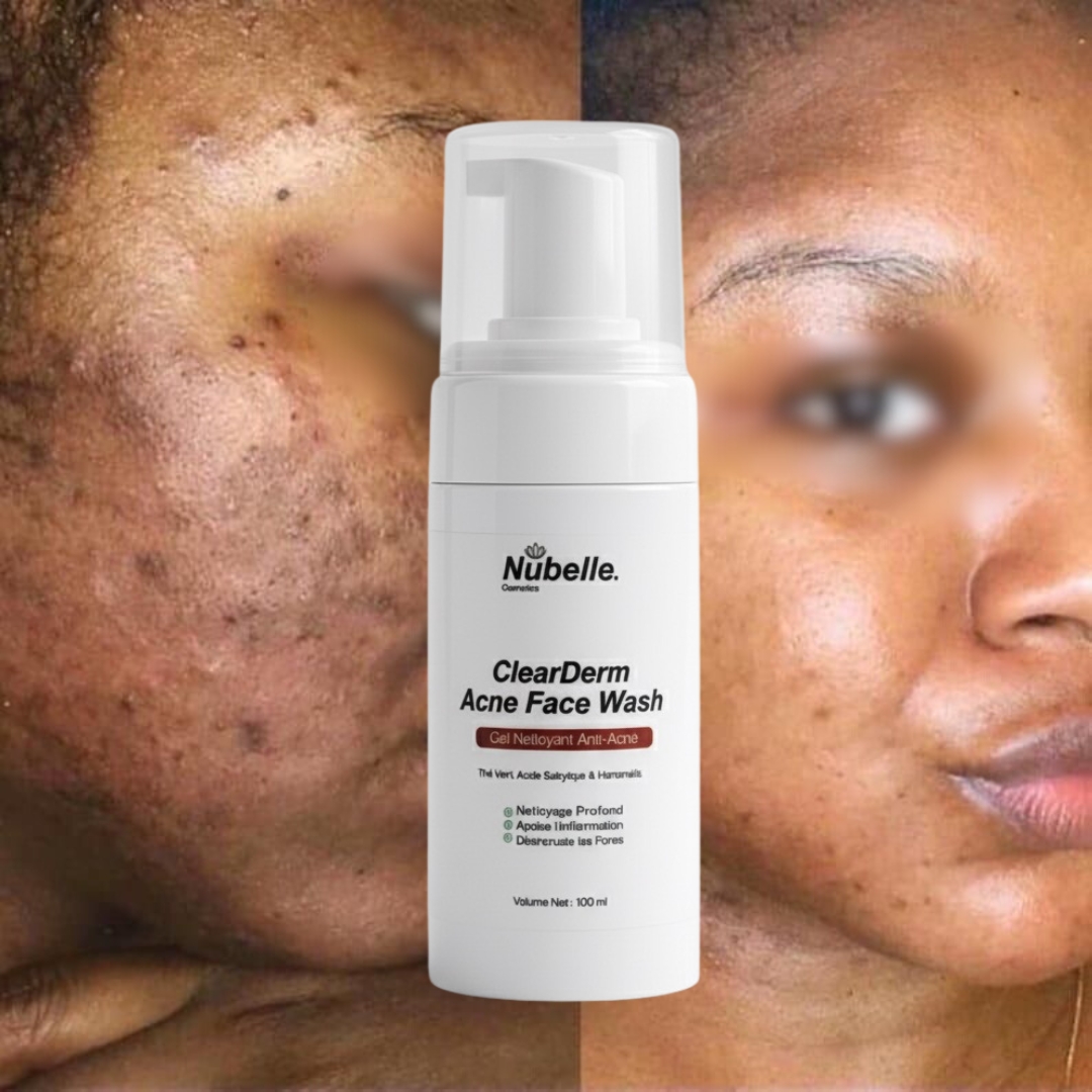ClearDerm - Nettoyant Anti-Acné