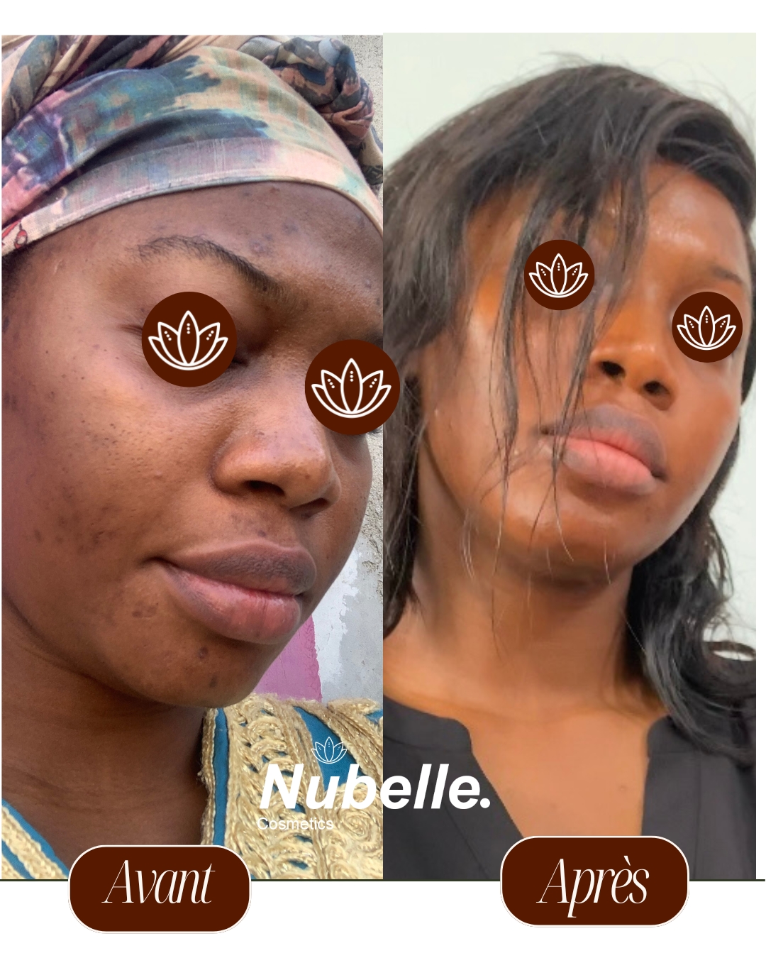 Kit Ant-Hyperpigmentation